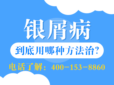 哈尔滨基本医疗保险银屑病